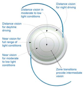 Glaucoma Eye Drops